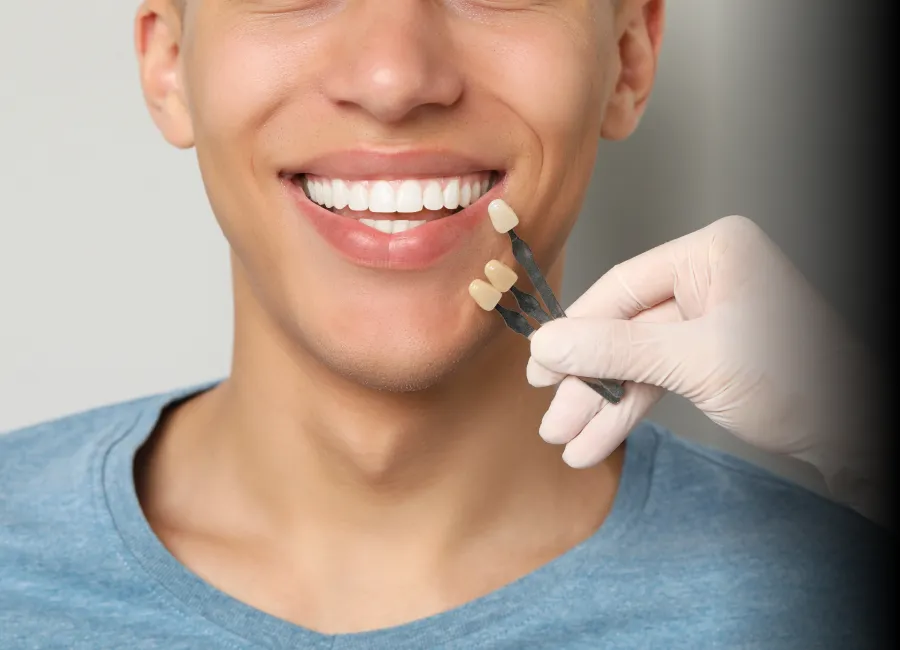 Take Home Teeth Whitening at [pracitice_name] in Santa Fe, NM